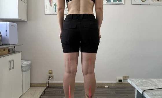 ANALISI POSTURALE SPERIMENTALE